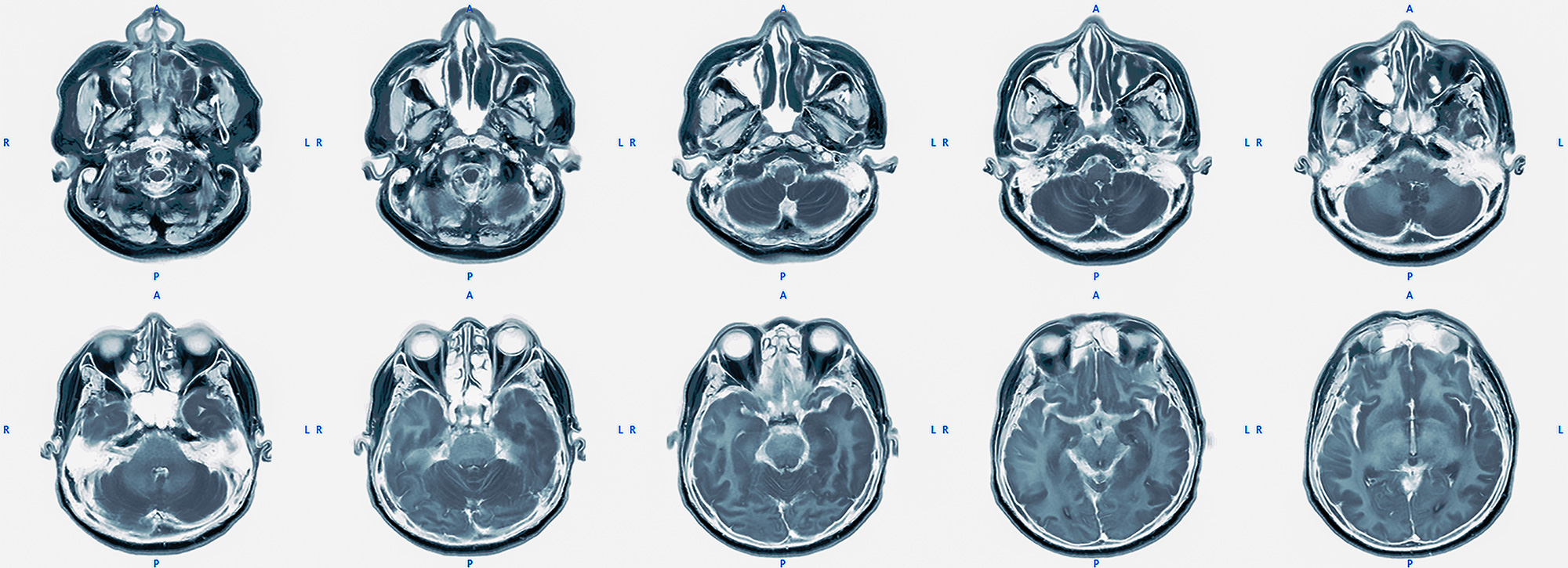 Image of brain scans